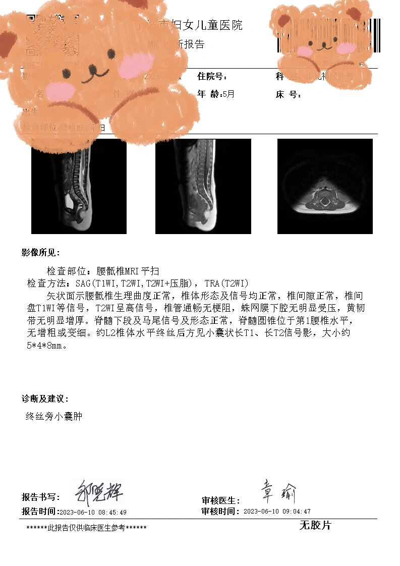 关于脊髓栓系