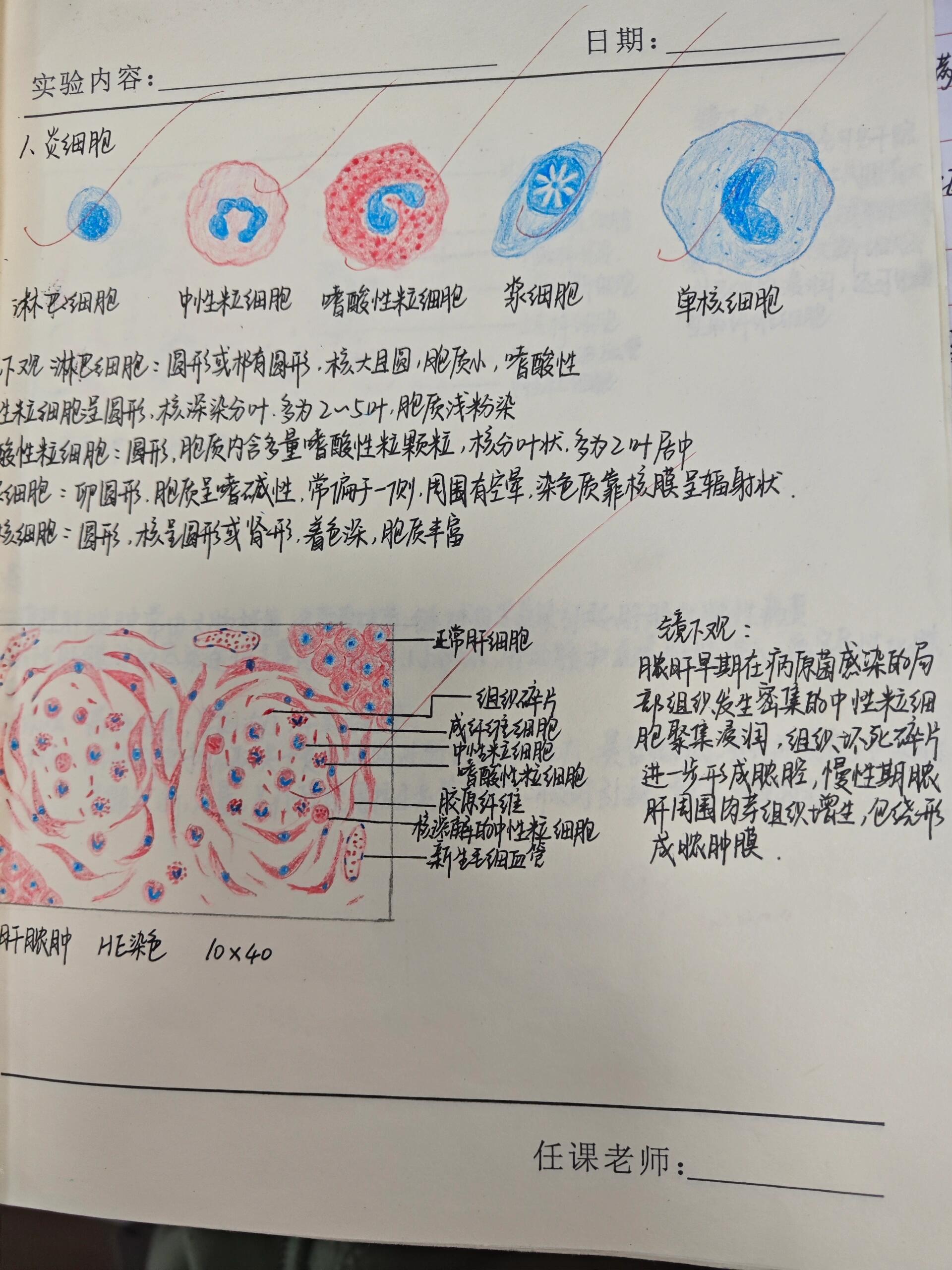 肝细胞索图片