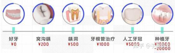 种一颗牙齿多少钱左右