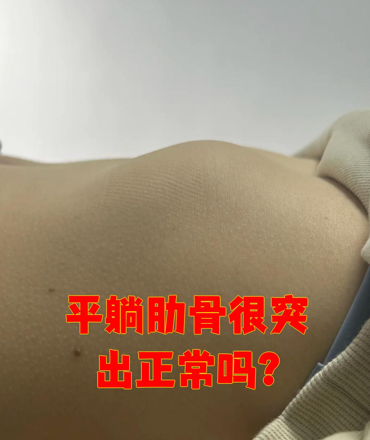 这种情况通常和缺钙有关,所以发现肋骨凸出时要注意补钙