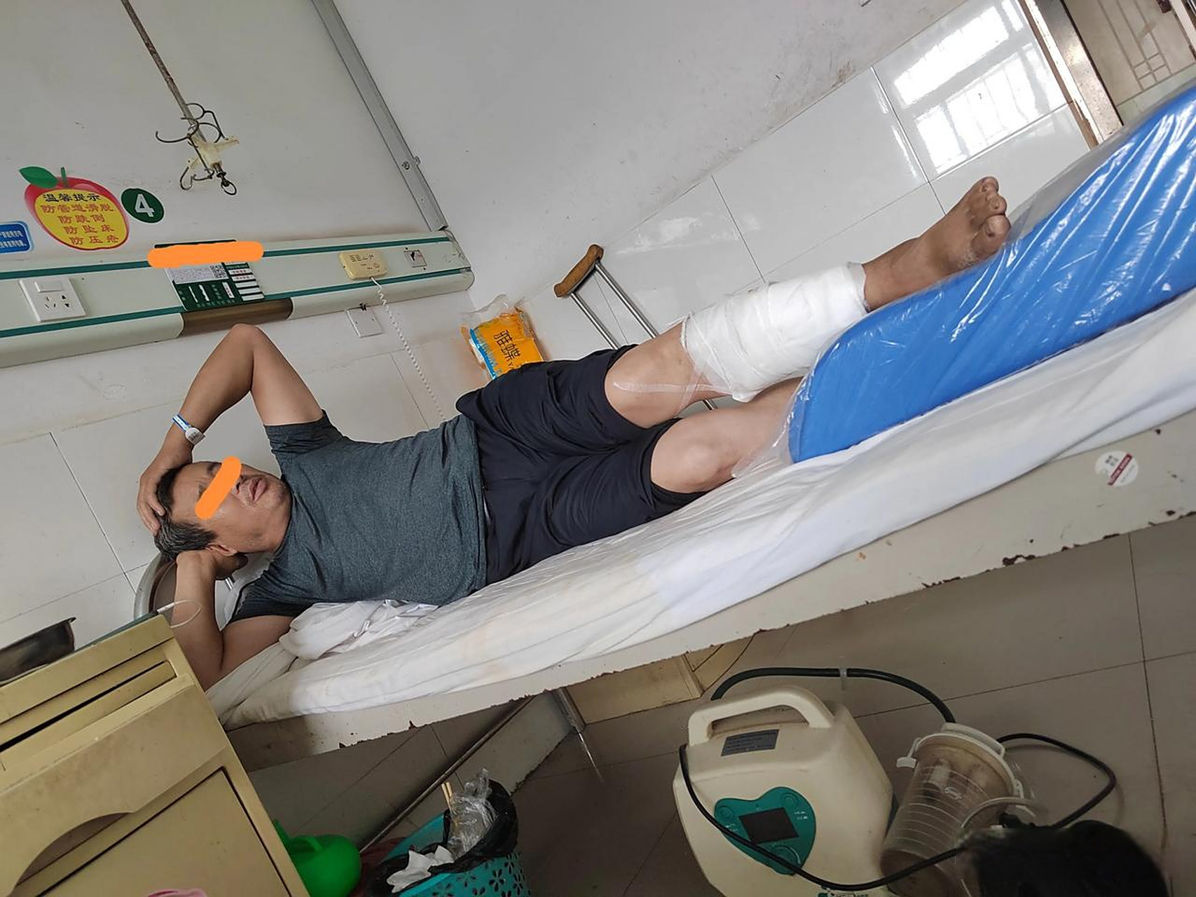 大哥今年54,腿部受伤,来医院7天了,一个人,没有陪护,每天三顿方便面