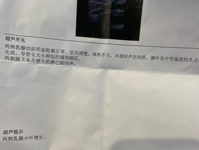 小叶增生和结节是两种不同的乳腺问题,很多人容易搞混