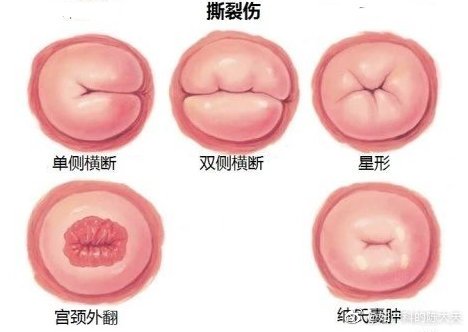 这个问题是在另一个平台别人邀请我回答的