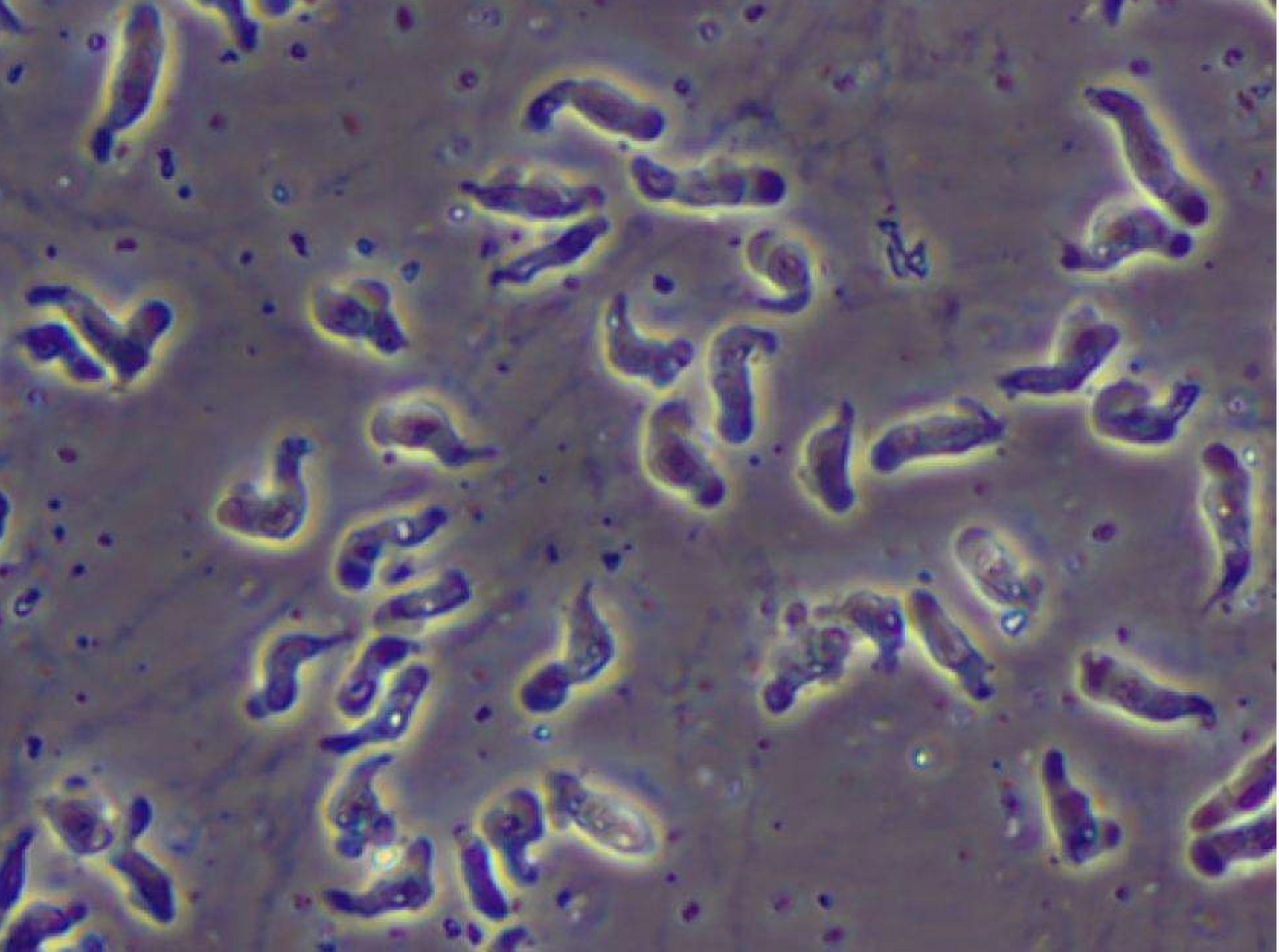 美国再现食脑虫#恐怖!
