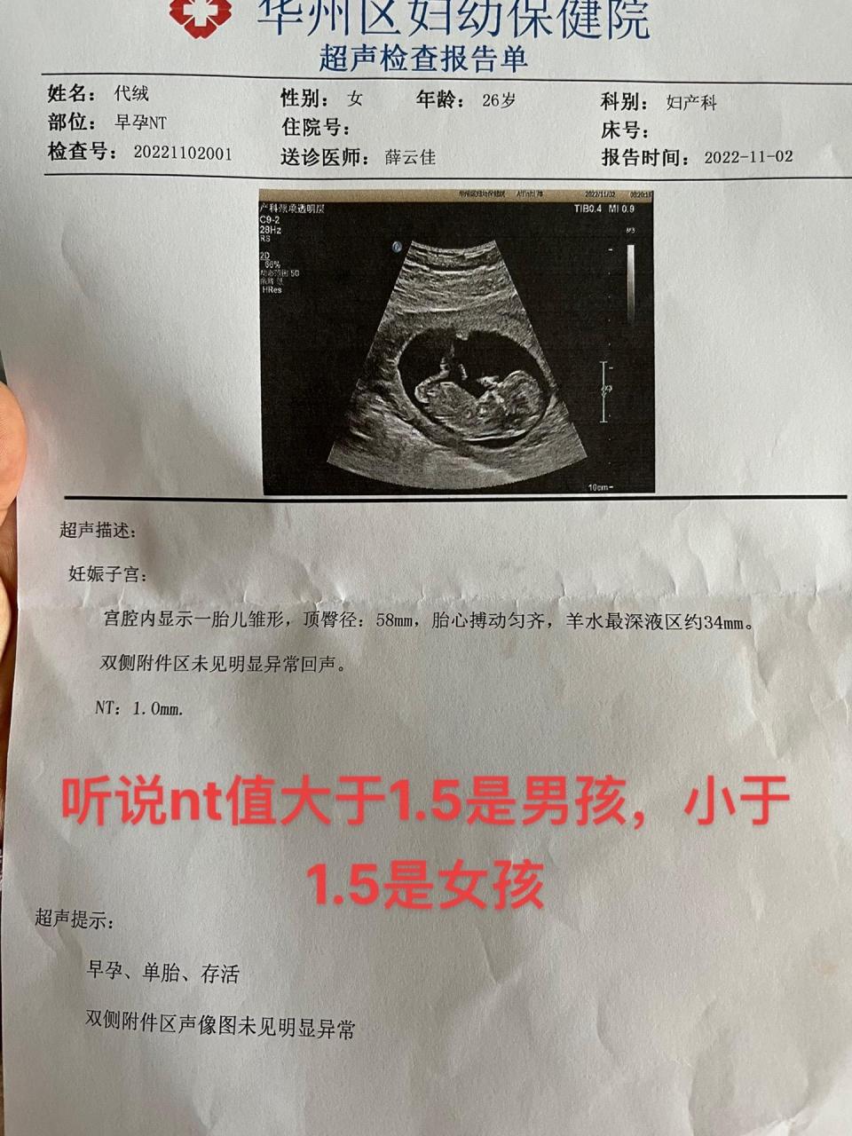 听说nt值大于1.5是男孩,小于1.