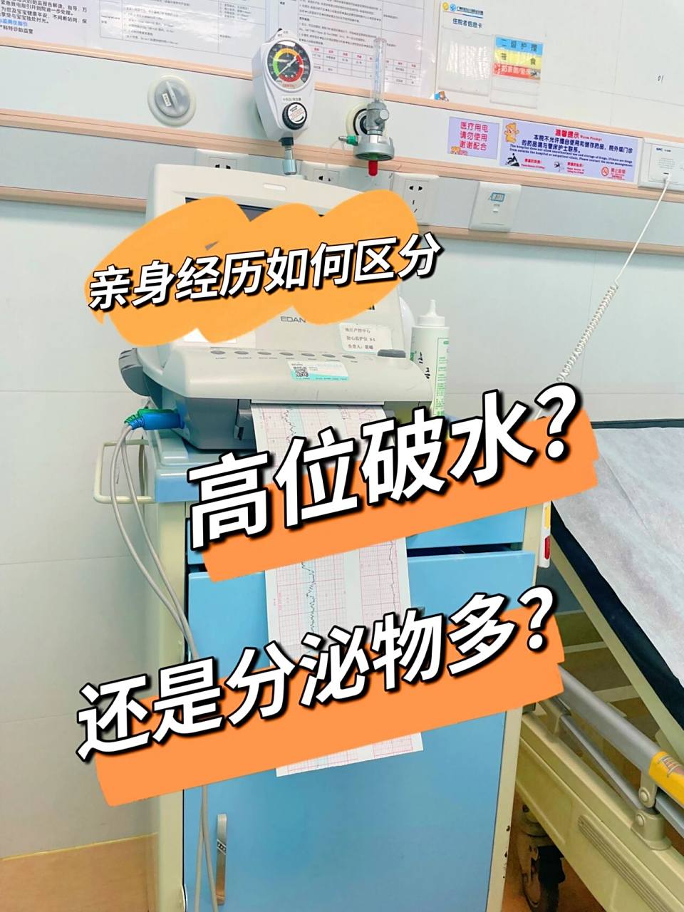 别慌先收藏|如何区分高位破水还是分泌物 96【高位破水】高位破水