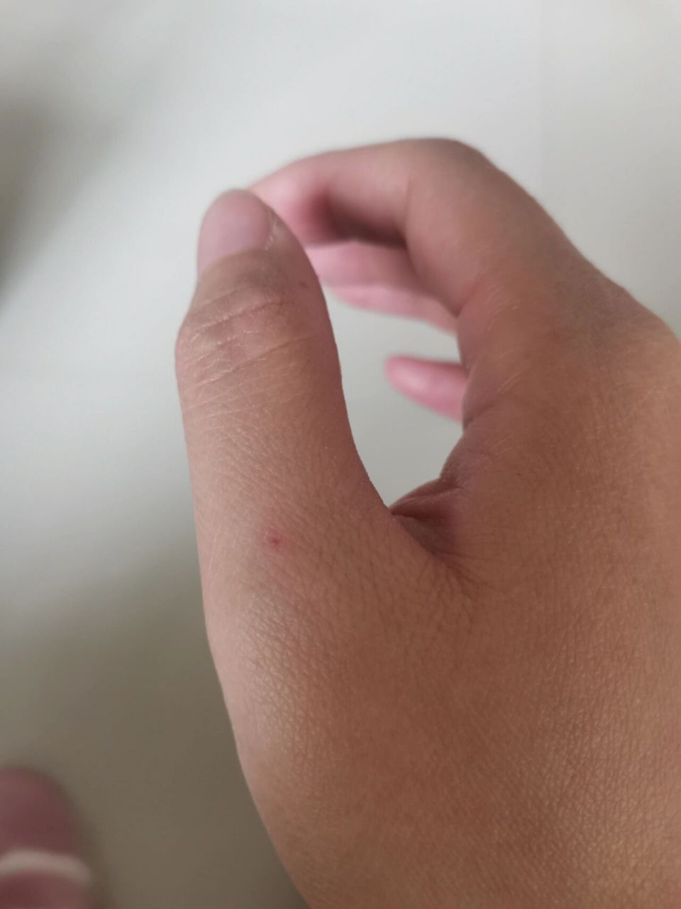 等到疼了才发现手上出现莫名其妙的小伤口 是不是到冬天手不灵光了,不