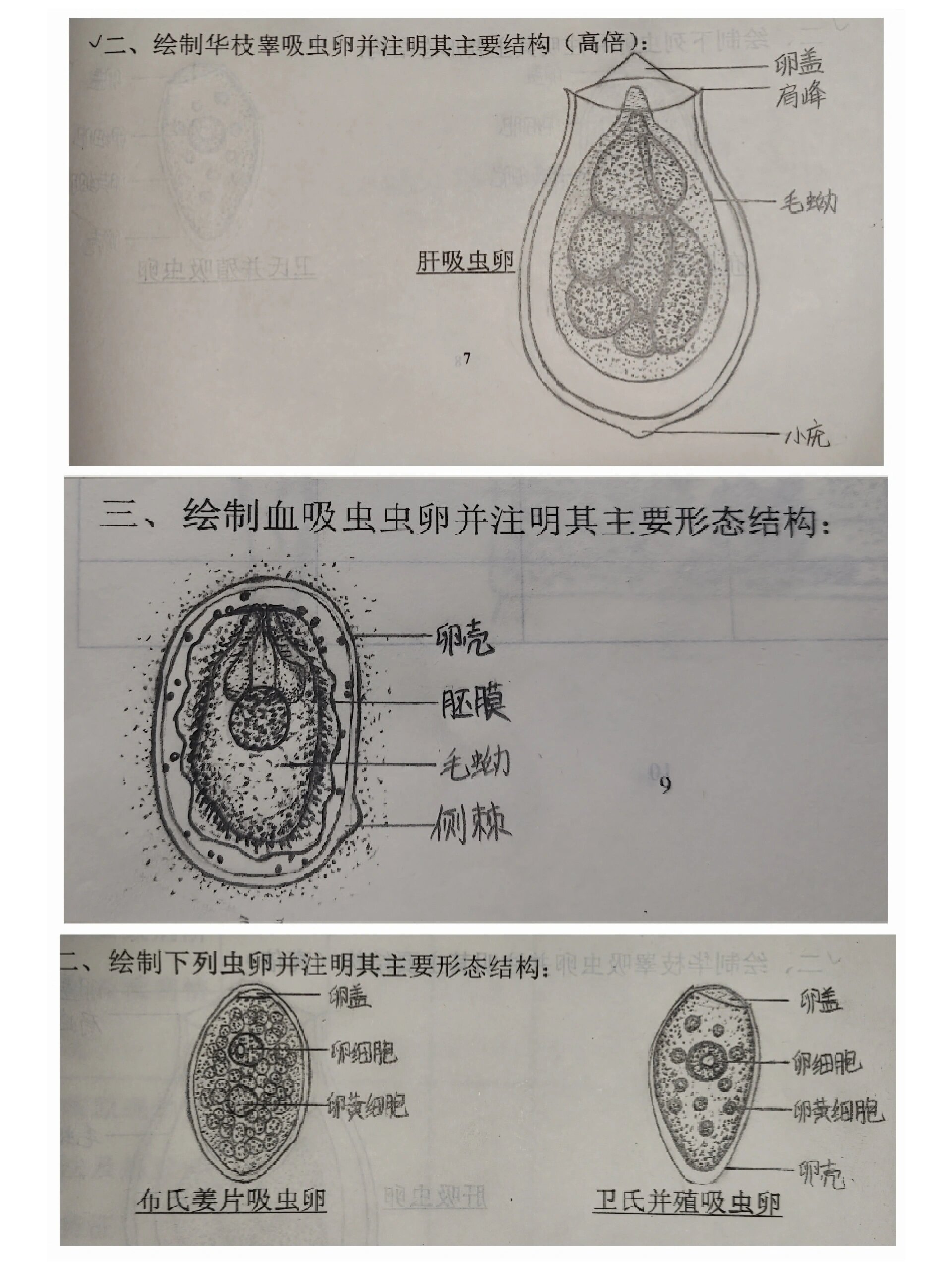 肠吸虫卵手绘图片图片