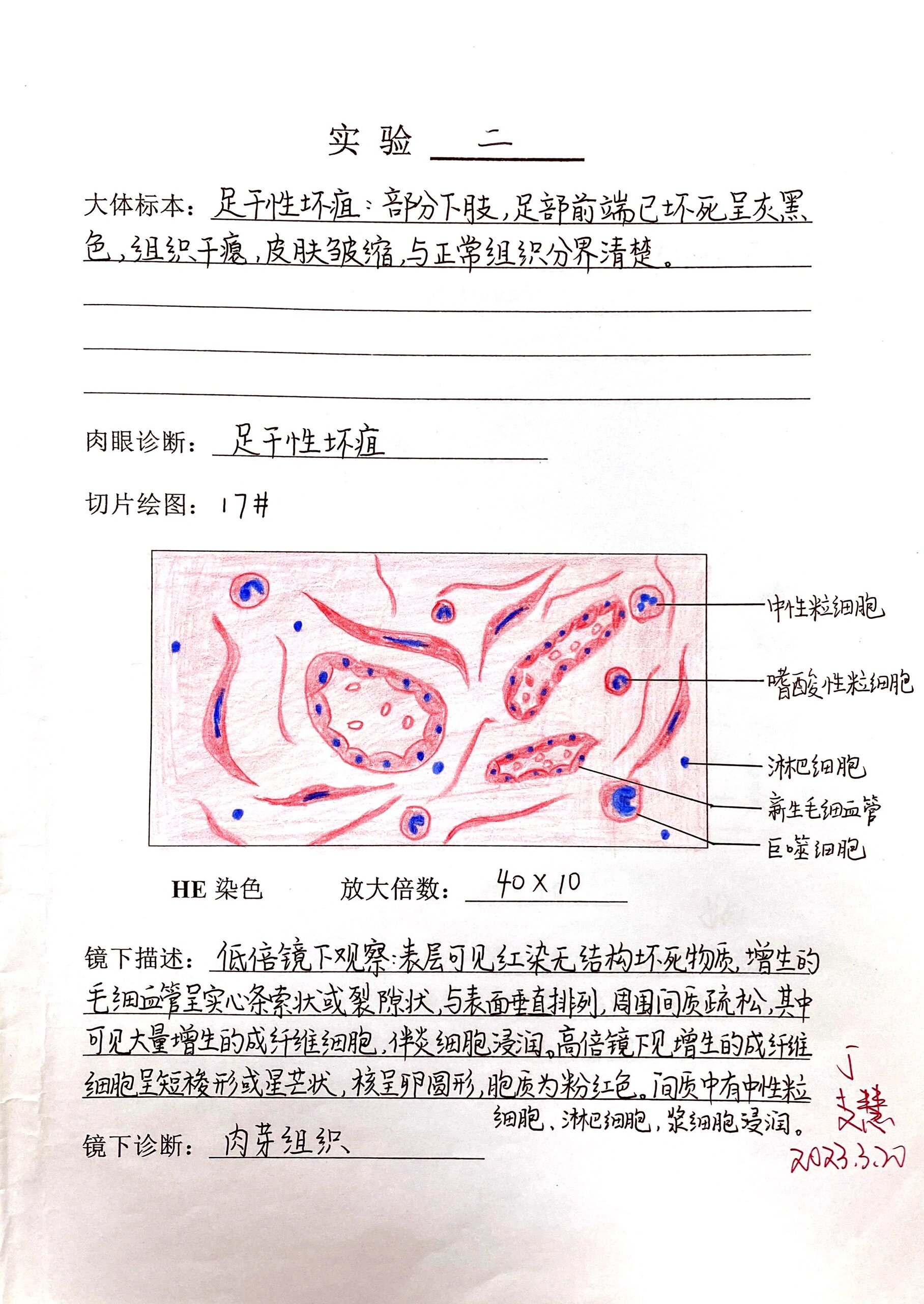 鼻息肉实验报告手绘图图片