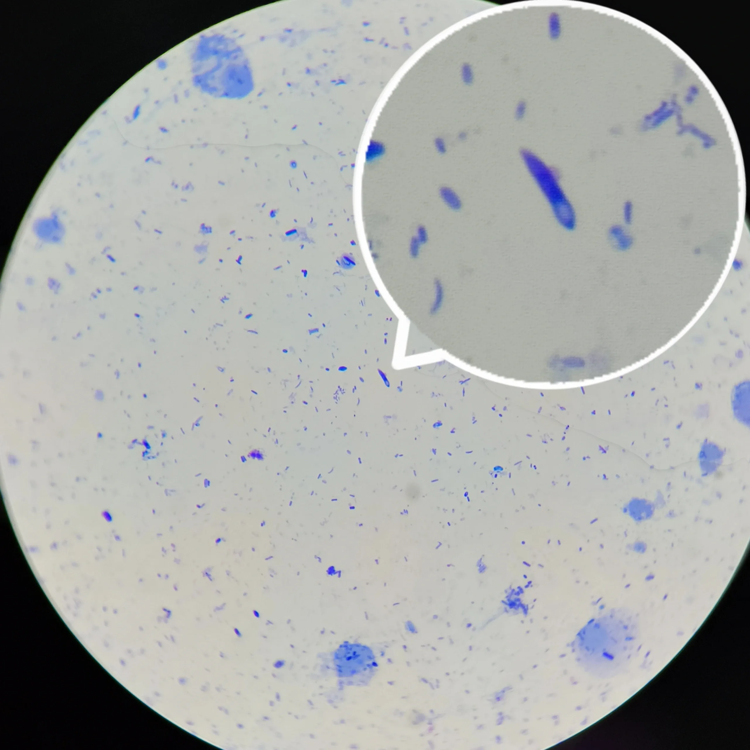 镜检〗芽孢杆菌产芽孢的位置与形态