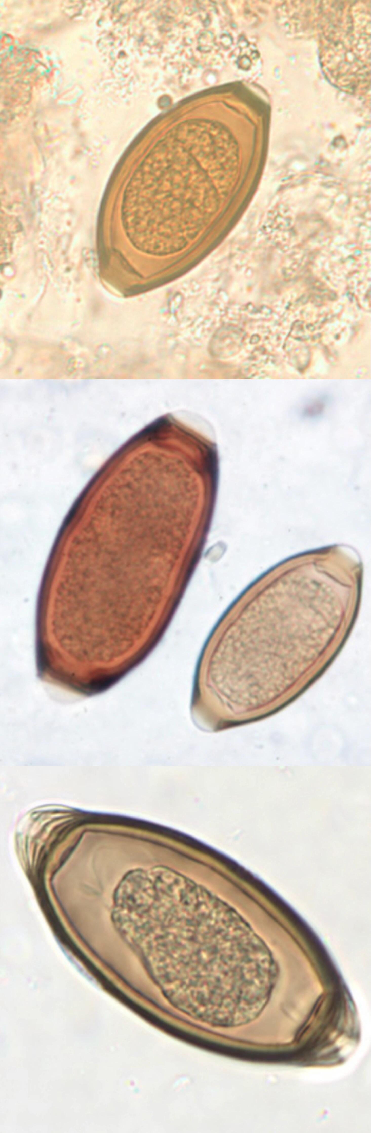 人体寄生虫卵图片