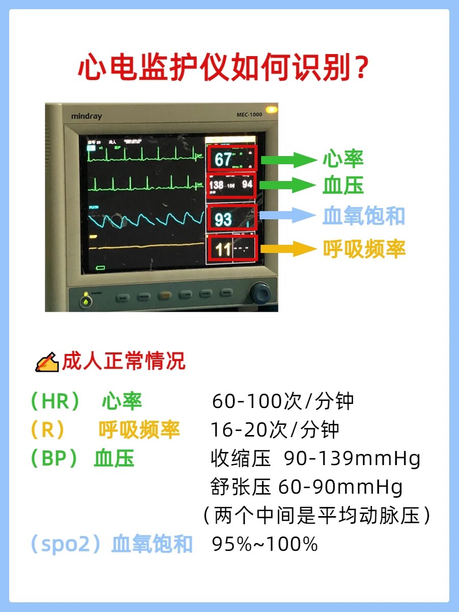 患者监护系统数据流图图片