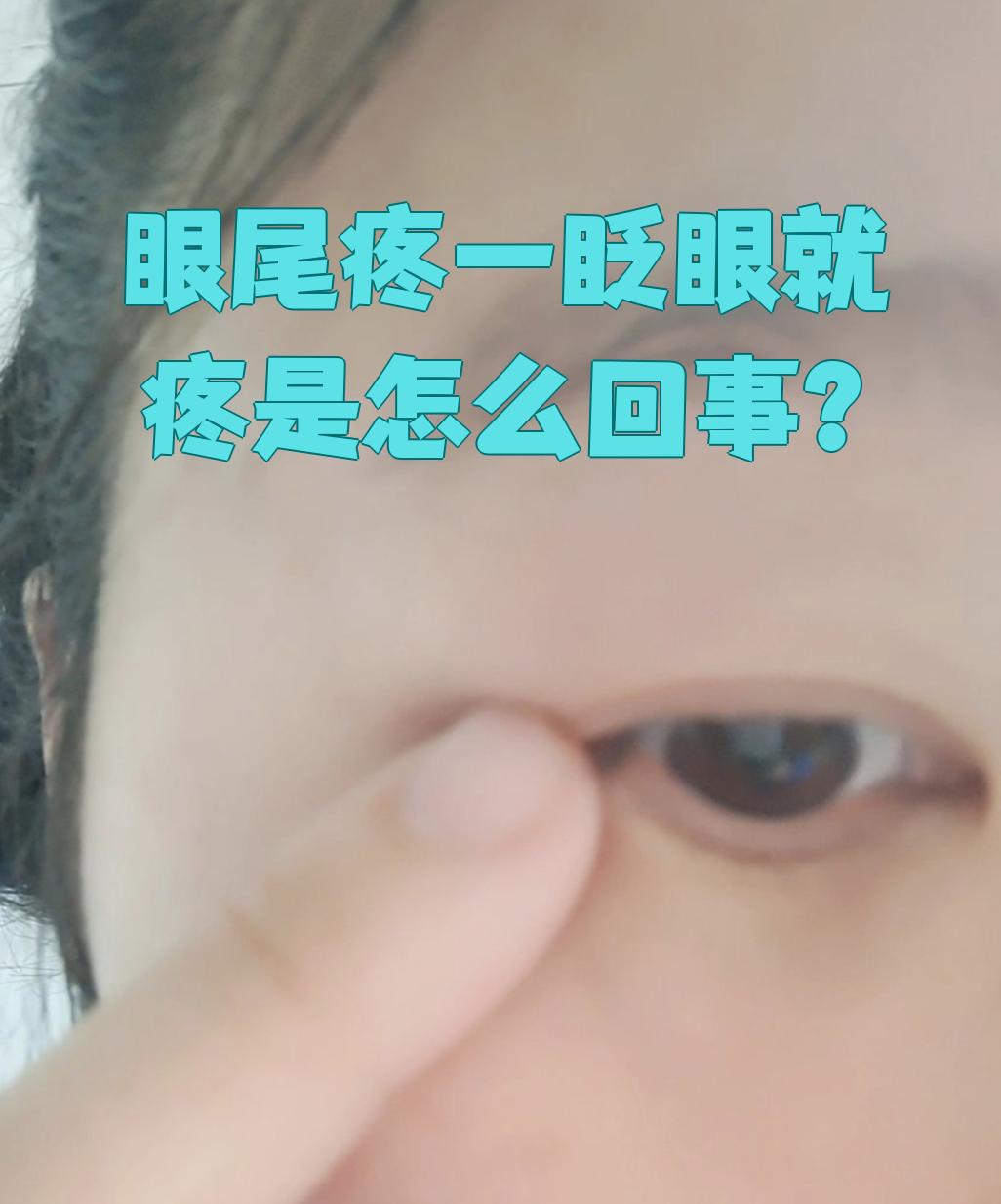 眼尾就是外眼角.如果这里一眨眼就疼,先看看有没有皮肤外伤