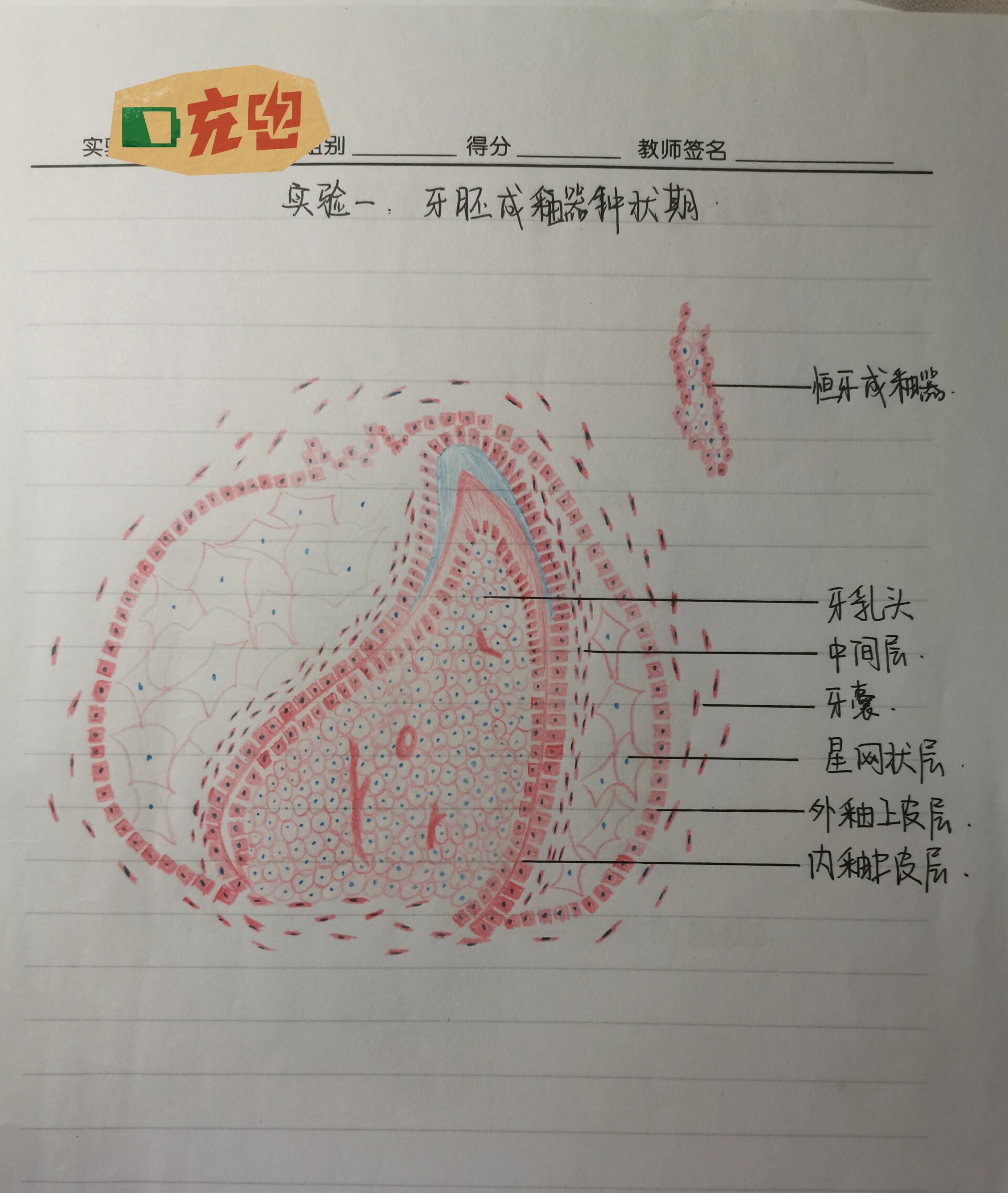 口组病绘图——牙胚成釉器钟状期 得分:89/10