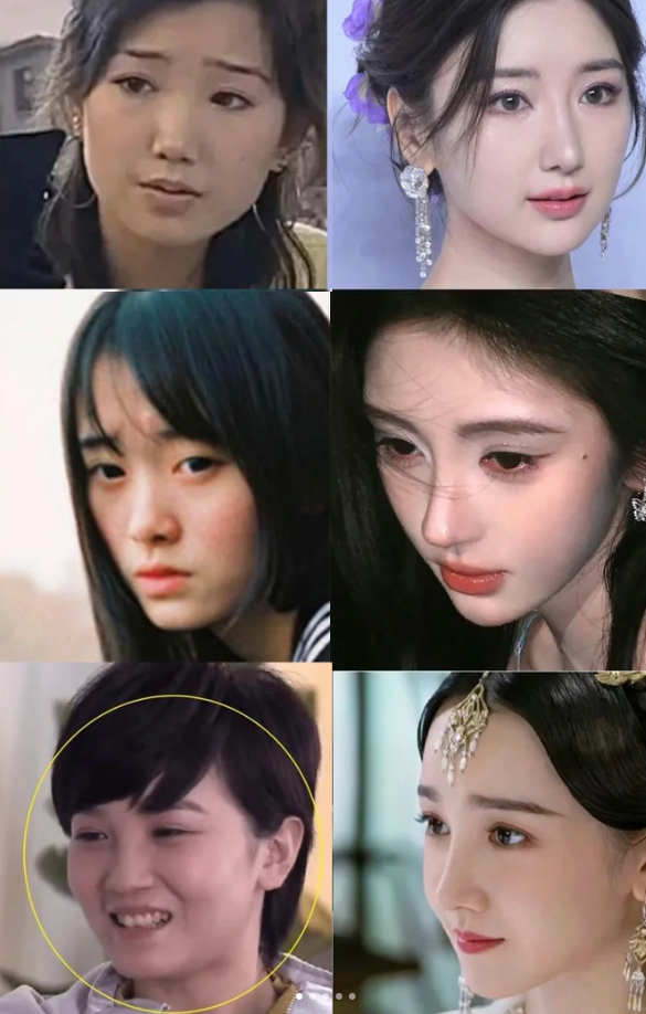 比如鞠婧祎,陈小纭,毛晓彤,今晨鼻子都做过