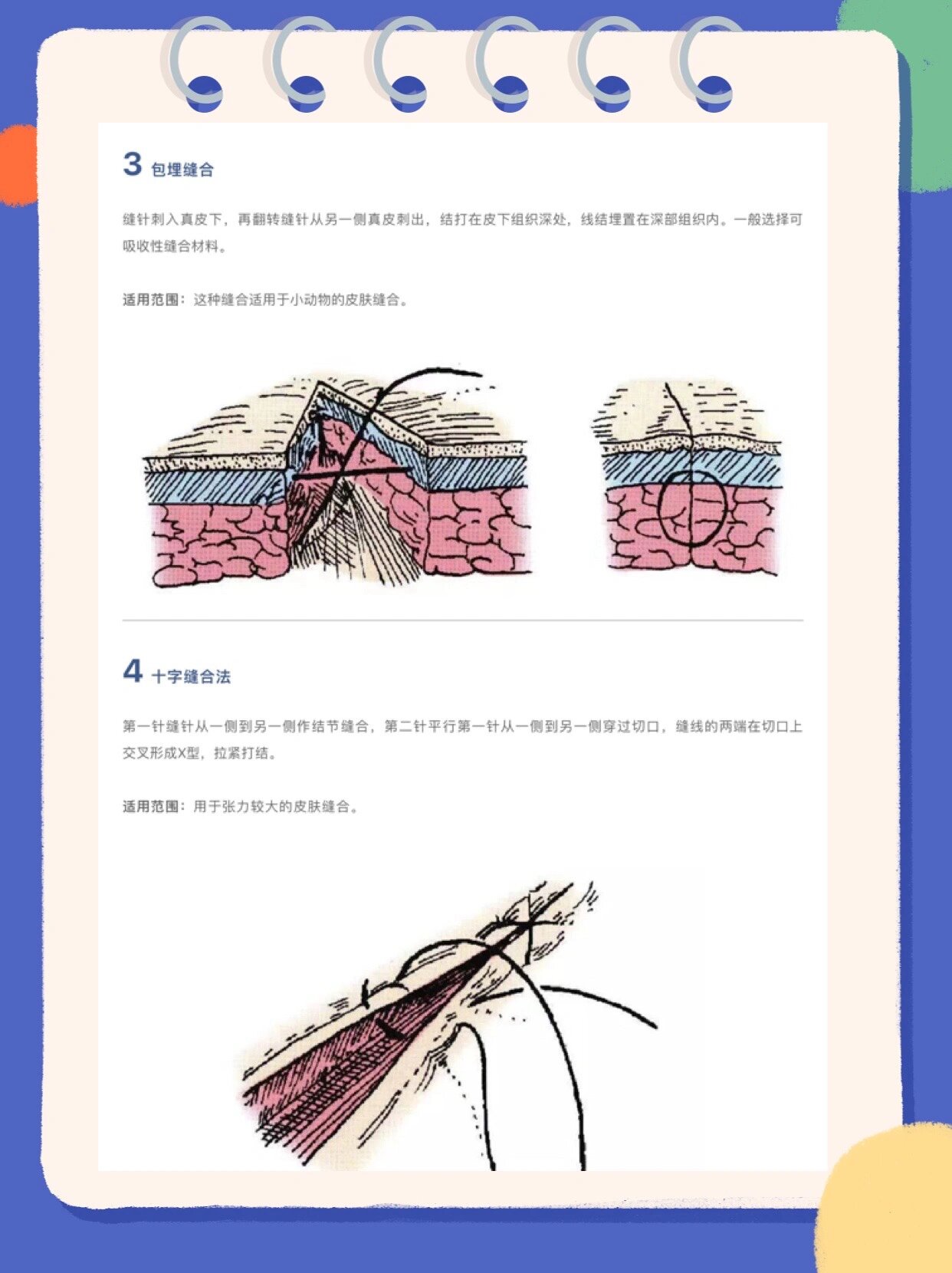 外科13种缝合方法图解图片