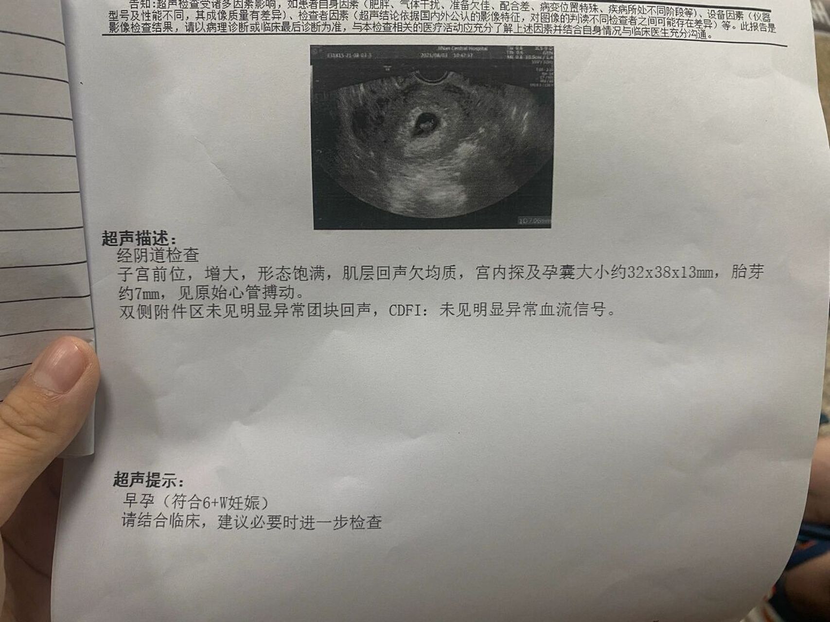 已经回正 第一次超声看宫内宫外的时候医生说位置偏右侧宫角,从网上查