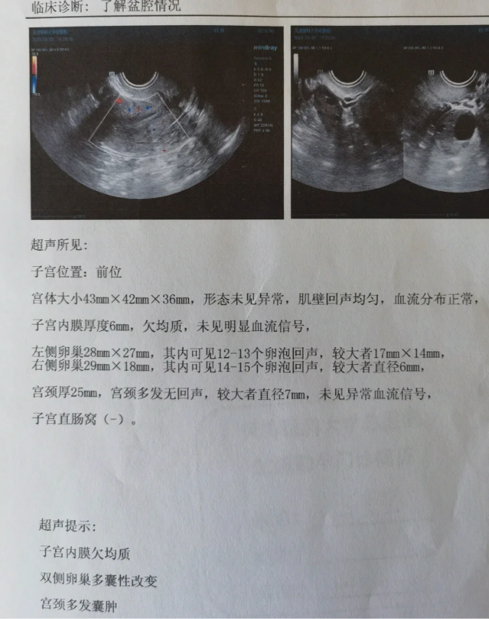 女性检查生育能力的项目有哪些?