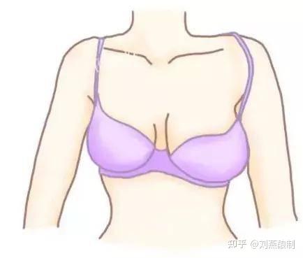左右胸不一样大怎么改善