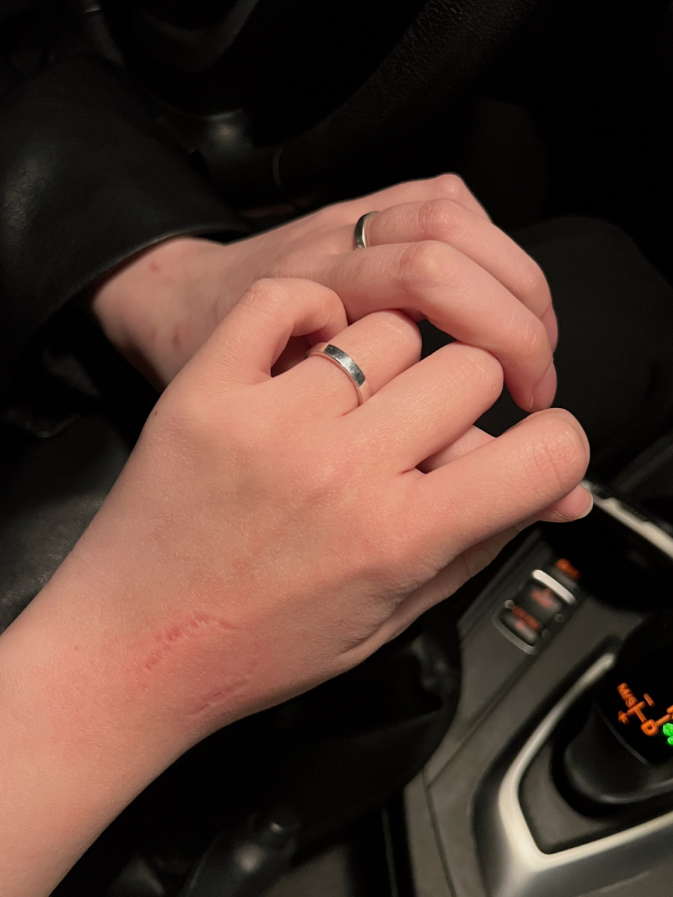 爱都是有痕迹的le 爱肯定是有痕迹的 吻痕 草莓 牙印 都算