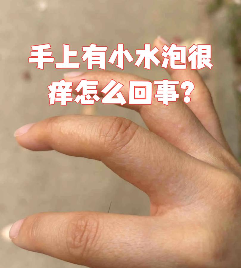 旧书摸起来手为什么会痒为什么在线 旧书摸起来手为什么会痒为什么在线