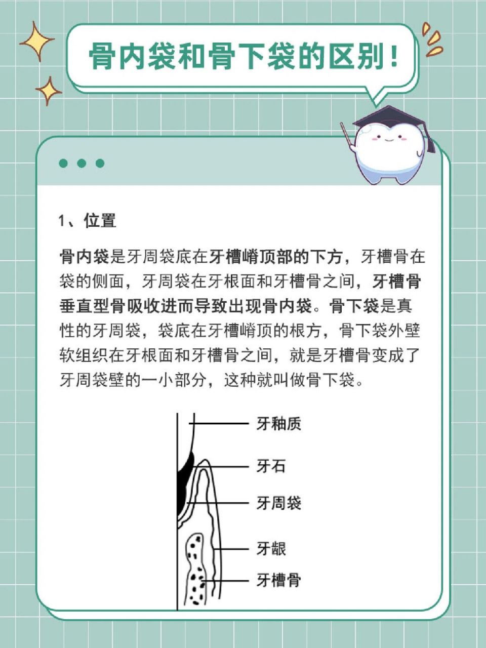 骨内袋和骨下袋的区别主要体现在位置,骨袋外壁结构,横贯纤维的排列