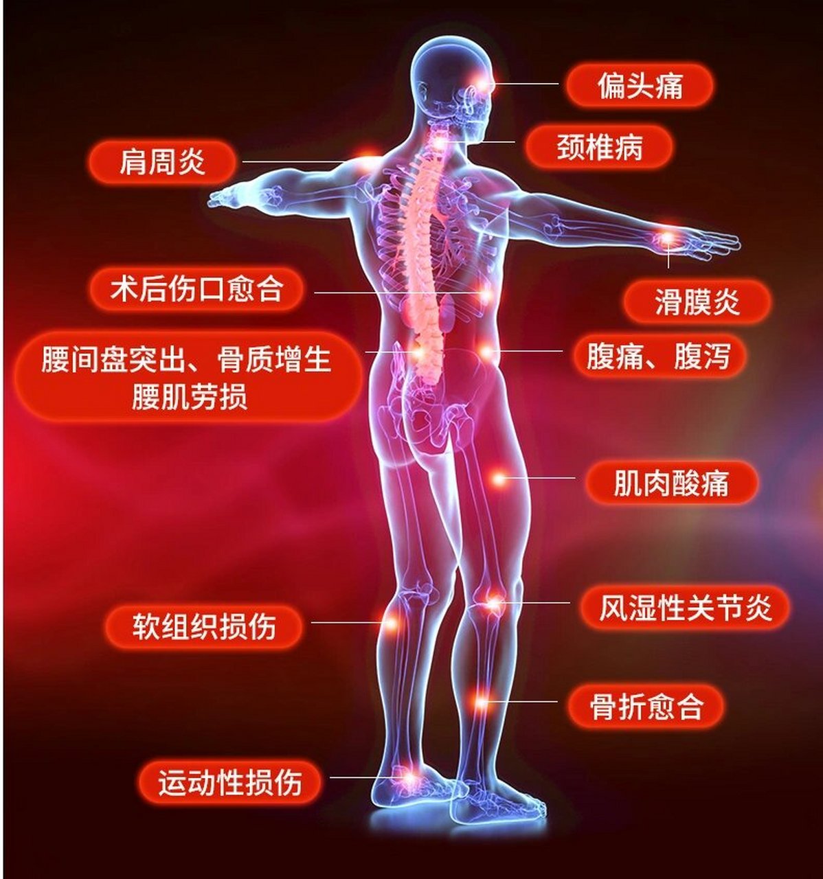烤灯 神灯 tdp=特定波谱治疗仪神灯的原理是通过加热