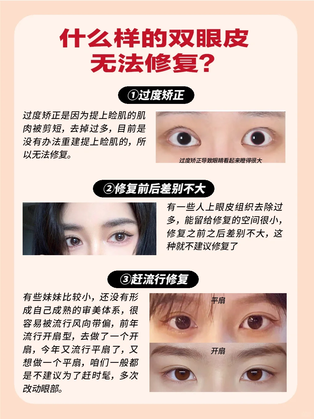 因为前几年比较流芭比眼,高鼻梁,现在来修复眼部过度矫正,双眼皮过宽