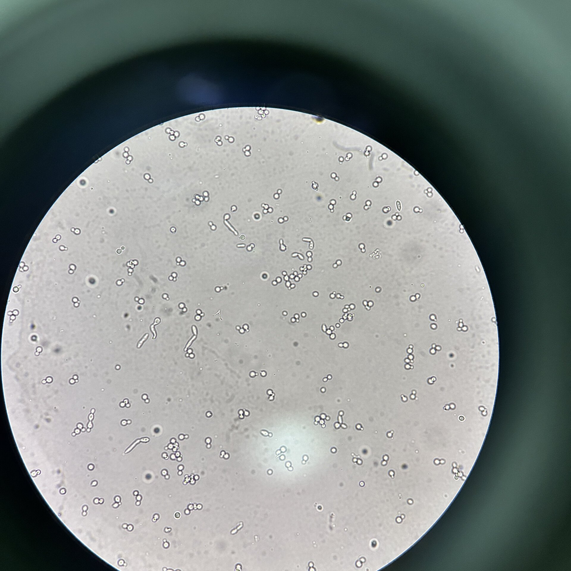 检验科镜检～真菌孢子1