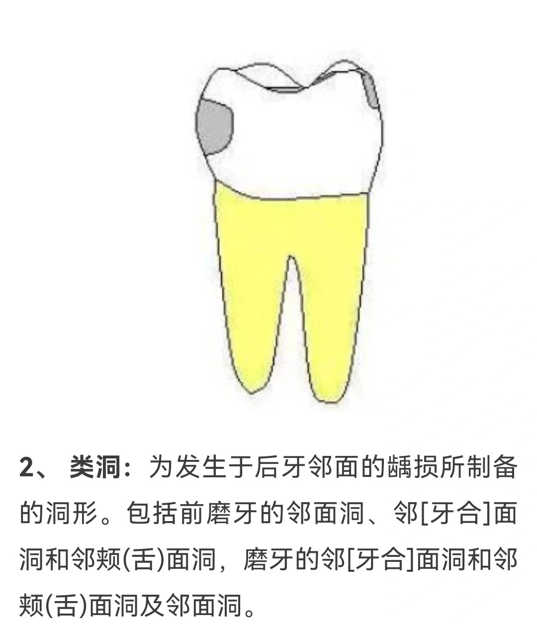 二类洞画图图片