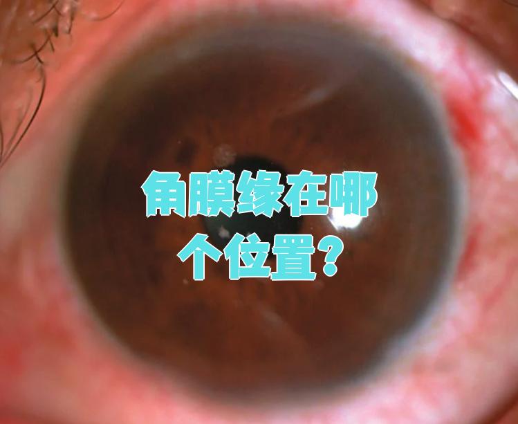 眼球壁外层的前1/6是透明的角膜,后5/6是白色的巩膜