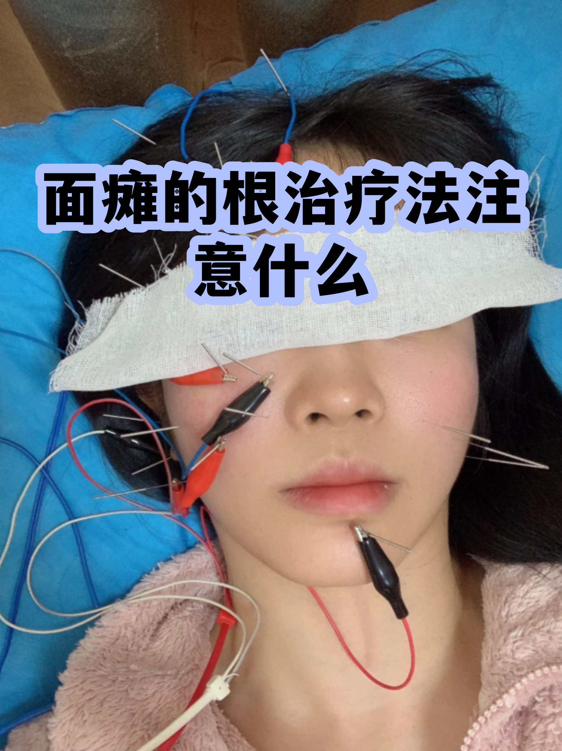 包含原武警总医院住院办理陪诊挂号缓解就医焦虑的词条