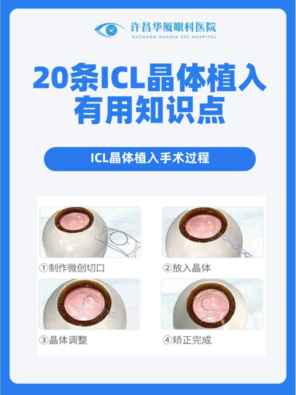 02icl全称叫后房型人工晶体植入术 2. icl手术年龄为18-45岁 3.