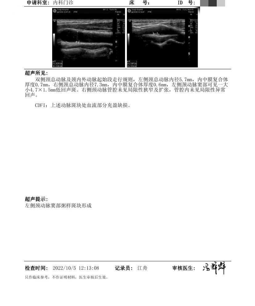 颈动脉斑块有经验的亲麻烦分享下,万分感谢