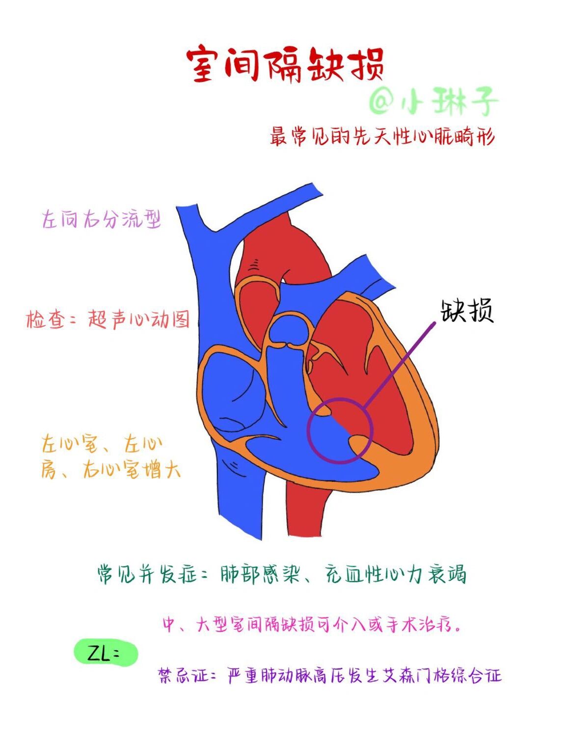 新生儿房间隔缺损图片