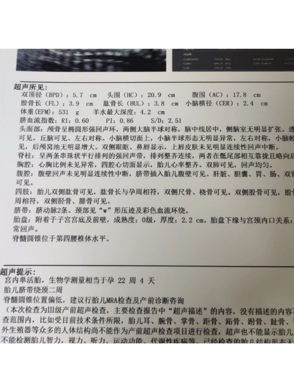 试管宝宝 四维脊髓圆锥低 在今天做四维之前,心里是紧张担心又激动