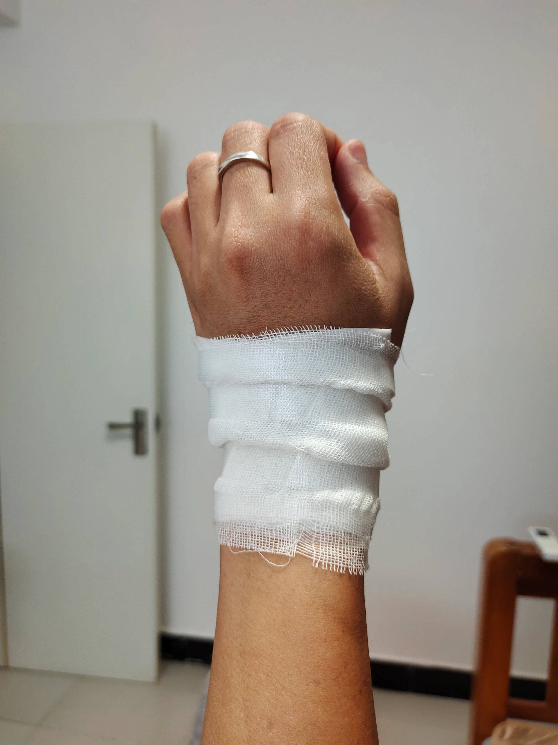 腱鞘炎,骨折式包扎98
