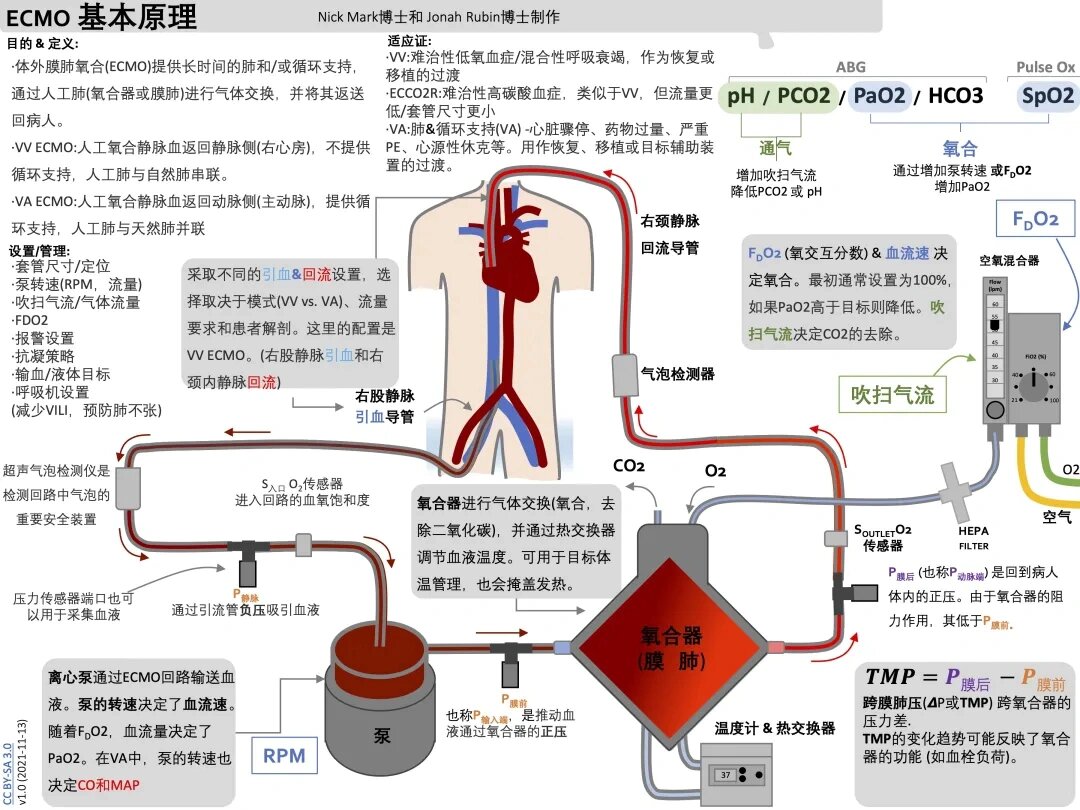 ecmo原理图解图片