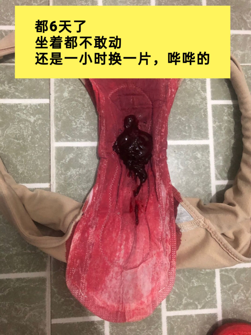 姨妈量少 痛经 宫寒淤堵 血块 从来没吃一粒92,5年的宫寒淤堵终于被