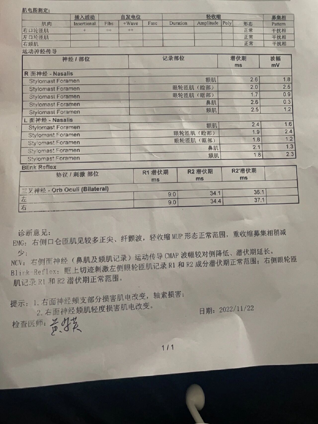 面神经肌电图结果解读图片