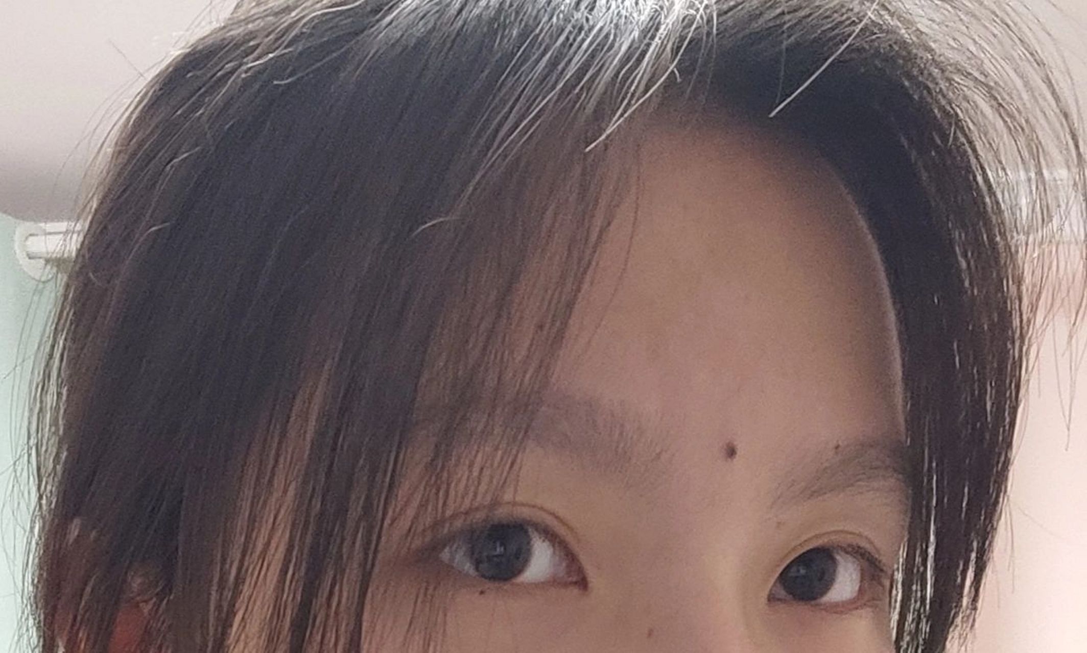 关于眉间这颗痣 小时候挺不在意这颗痣的,长大爱美了越来越在意了