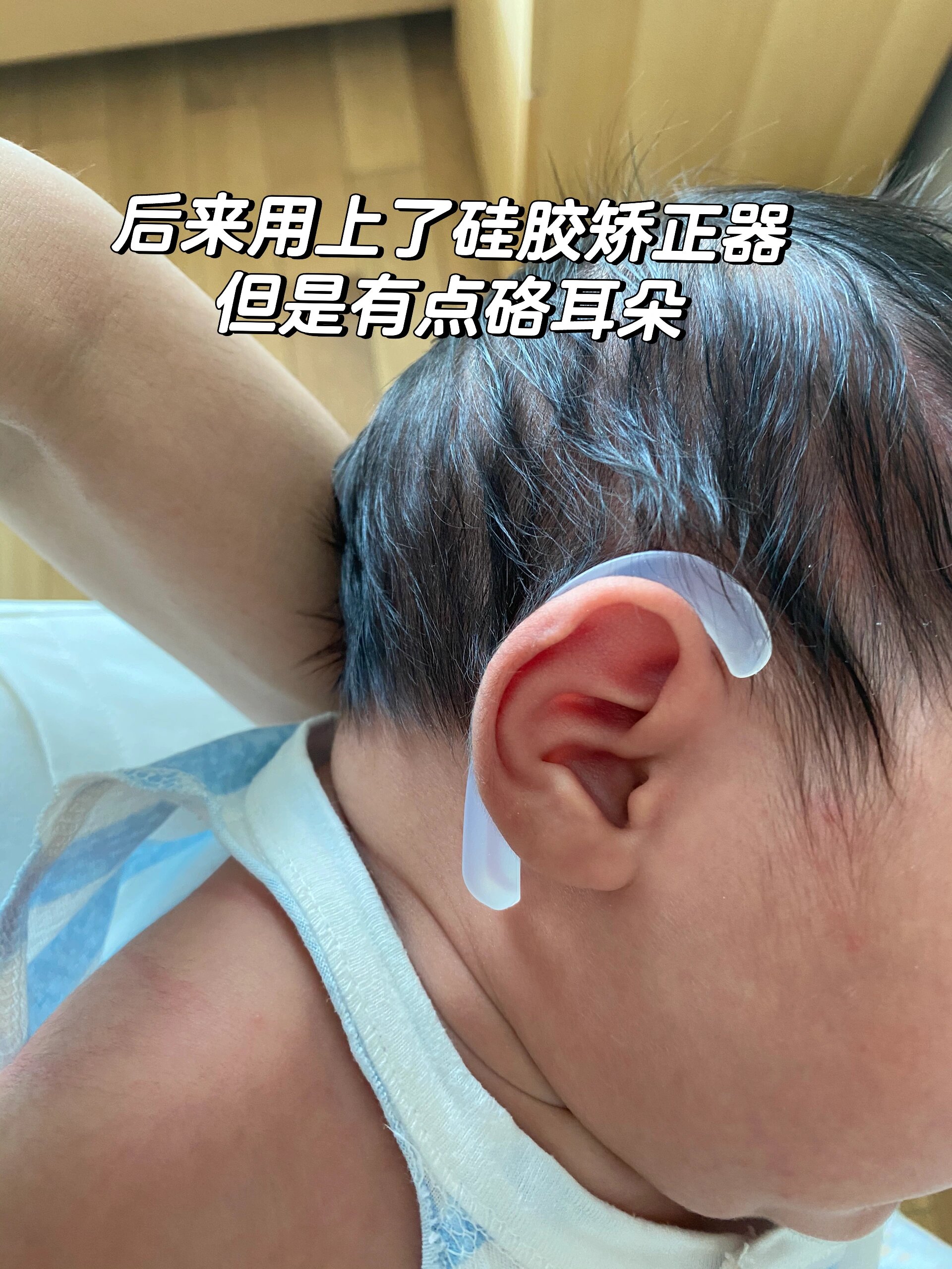 关于月子里宝宝正面看不到耳朵 吉祥出生的前几天正面看不到耳朵,我