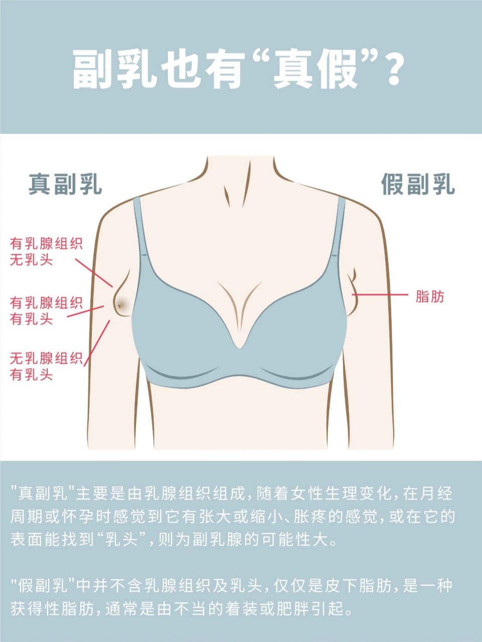 副乳长什么样乳腺图片