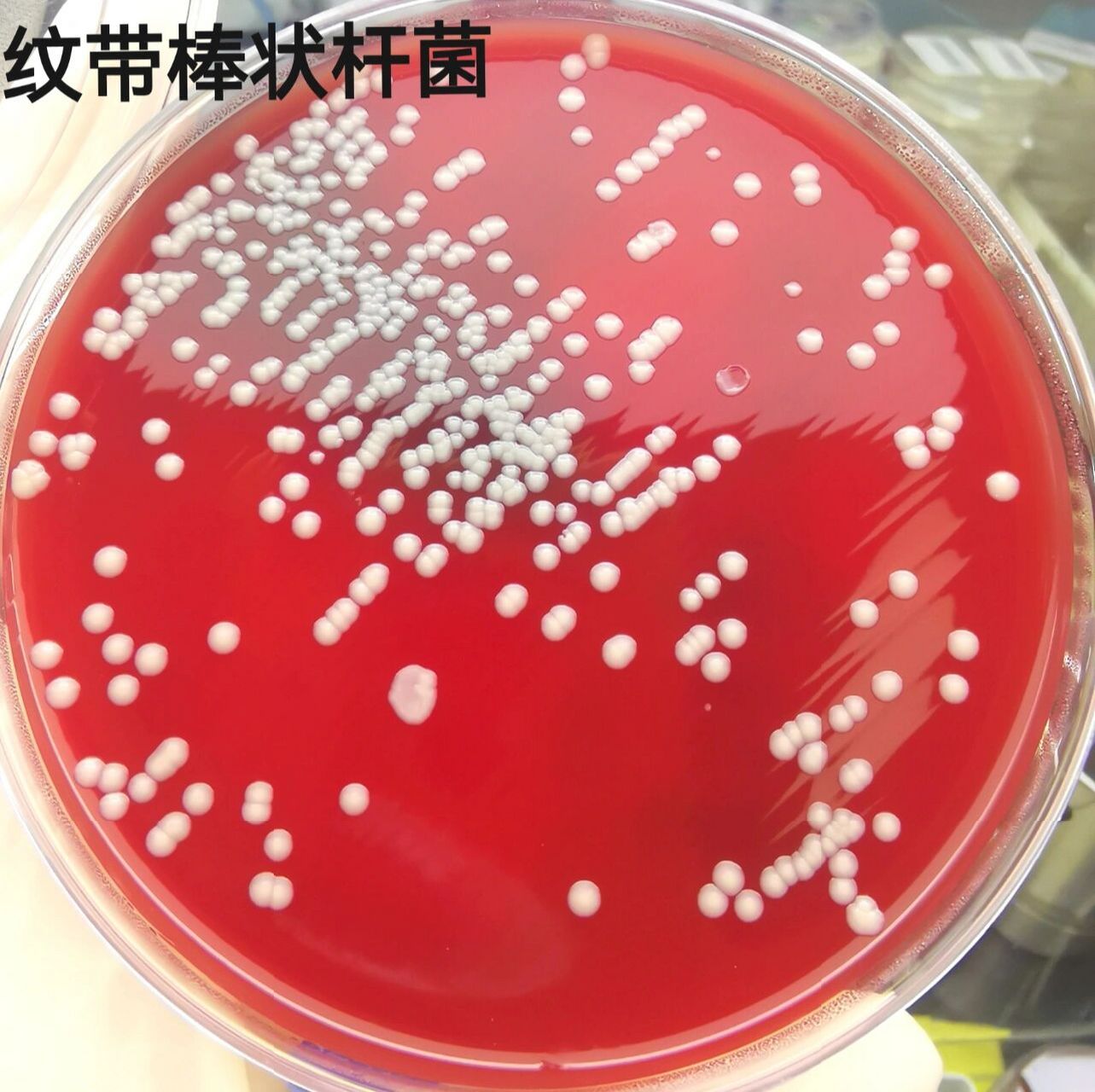 纹带棒状杆菌 尿标本革兰染色:阳性短杆菌