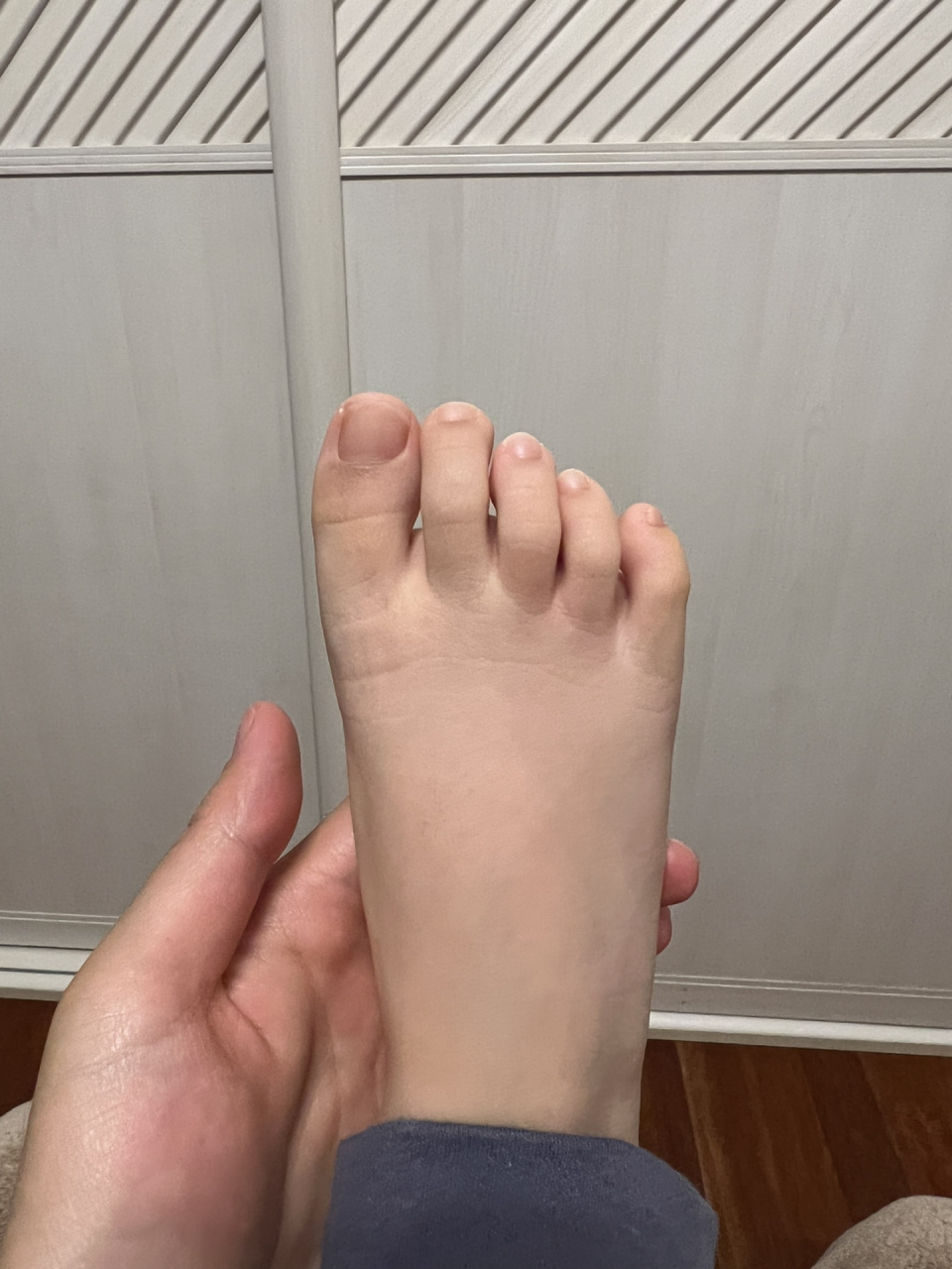 大脚趾为什么这么弯 以后会不会更弯然后压第二个脚指头下面,变成那种