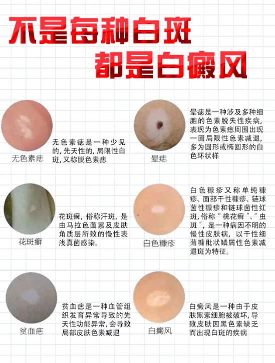 初期最明显的症状就是皮肤颜色发生变化