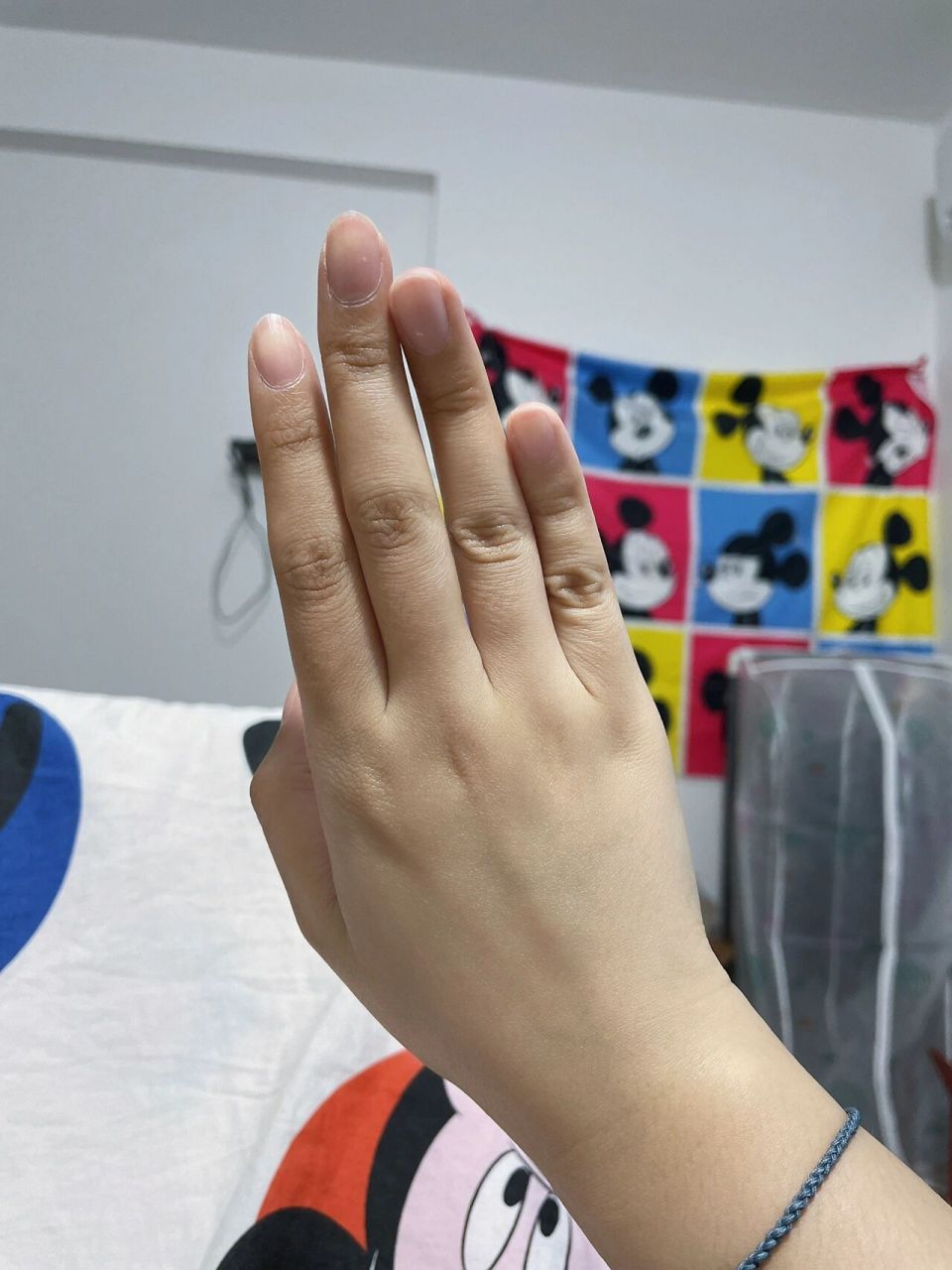 写字把手指写歪了 从小写字中指就硌的特别痛 其他几个手指还会扣到