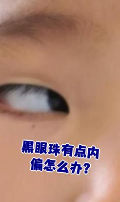 黑眼珠有点内偏怎么办?