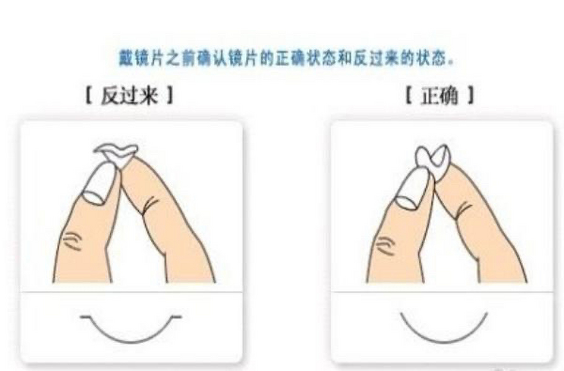 软性隐形眼镜正反面如何区分