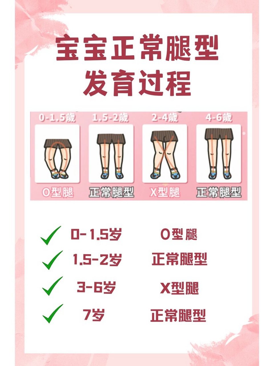 干货 |宝宝腿型正常发育过程‼️ 🌵正常宝宝的腿型应该是怎么